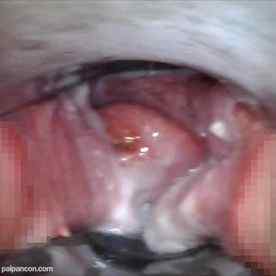 FC2-PPV-2960462 - (期間限定)クララちゃん １８歳　処女喪失直後の子宮開発＃１