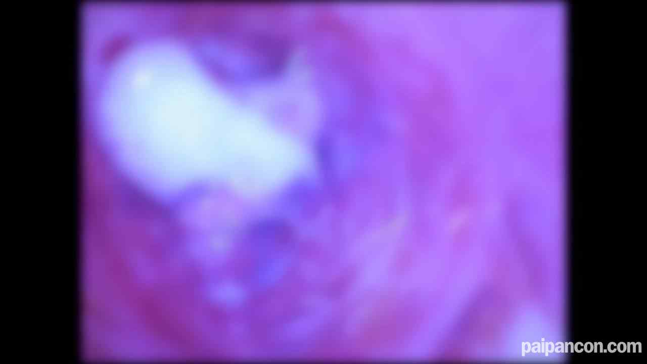 FC2-PPV-4658241 - ★特典で無修正と膣内カメラ ♀145 ウブでピュアなさくらちゃん。こんなおなごでもでAVに出なきゃいけないこんな世の中、、、でもたっぷり中だしです♡ thumbnail_9.jpg